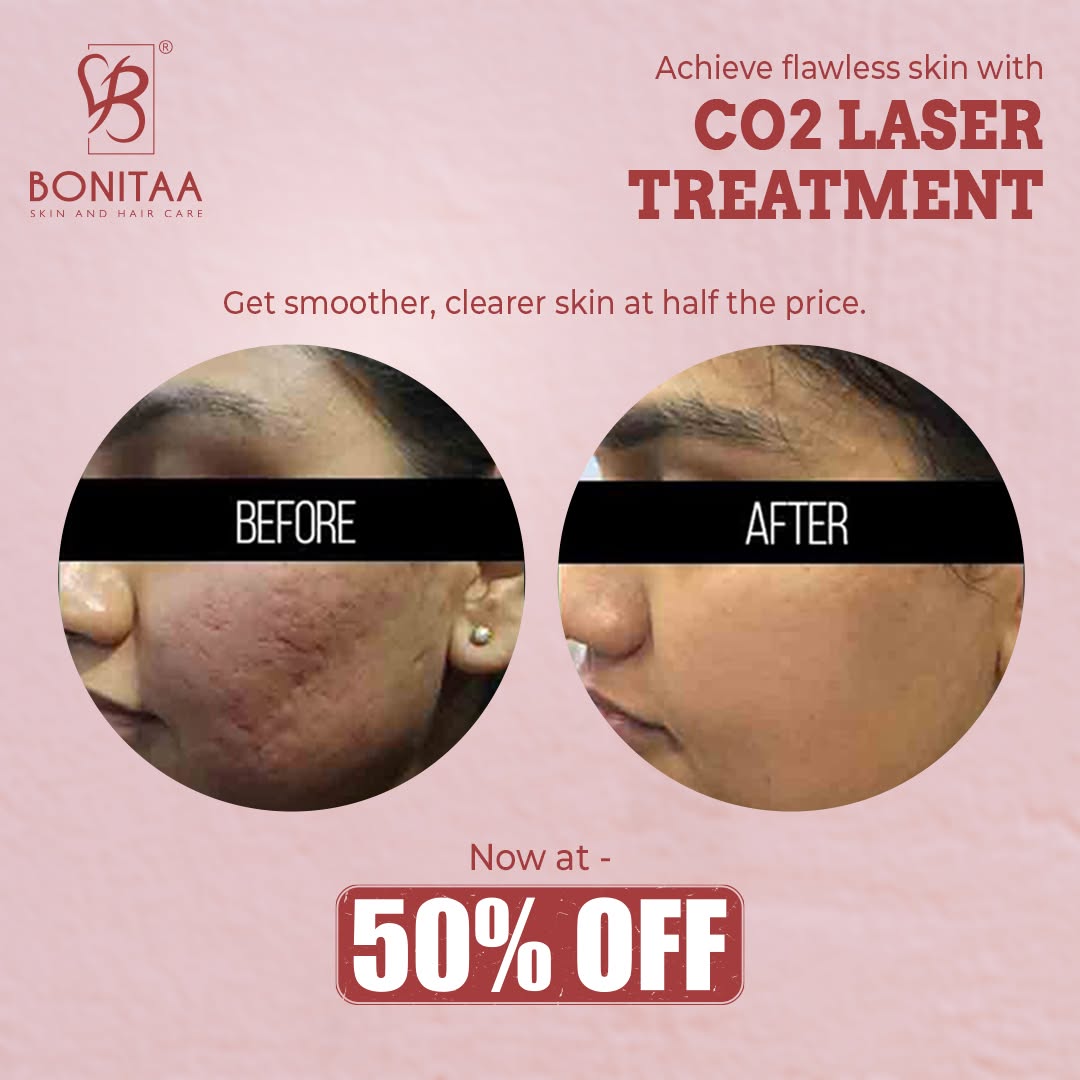 Skin treatment visual one