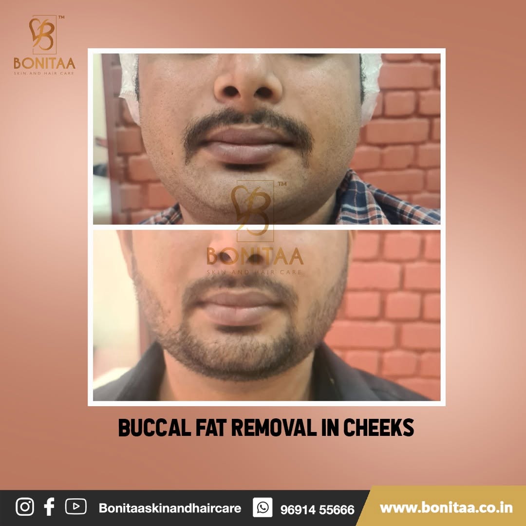 Skin treatment visual two